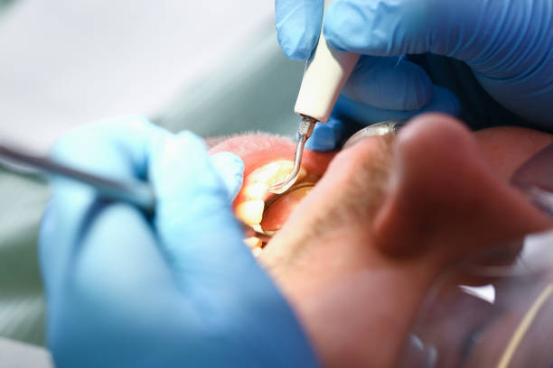 Best Emergency Treatment for Jaw Pain or Injury in Cumberland, IN